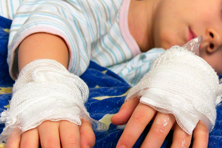 Reportan 8 menores quemados por pirotecnia en Tamaulipas