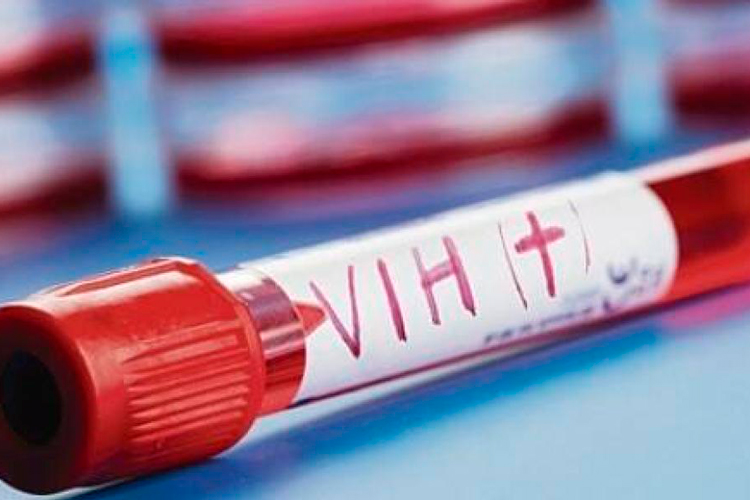 Se dispara VIH en Tamaulipas